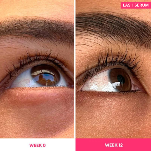 Eyelash Serum to Grow Lashes | Lash Serum That Works | Growth & Regrowth