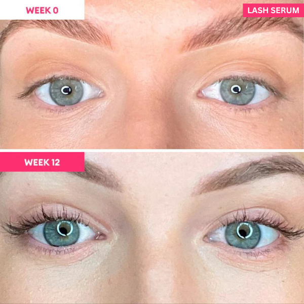 Eyelash Serum to Grow Lashes | Lash Serum That Works | Growth & Regrowth