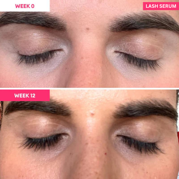 Wimpernserum für Wimpernwachstum | Wimpernserum, das wirkt | Wachstum und Nachwachsen 