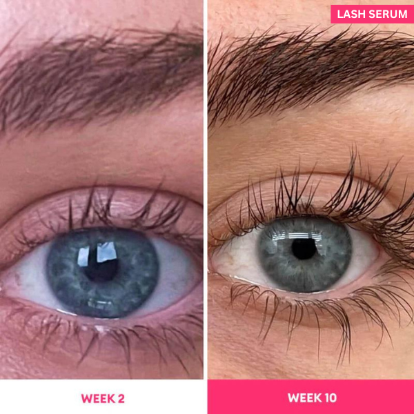 Eyelash Serum to Grow Lashes | Lash Serum That Works | Growth & Regrowth