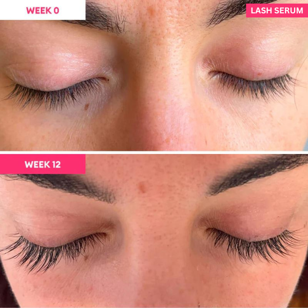 Eyelash Serum to Grow Lashes | Lash Serum That Works | Growth & Regrowth