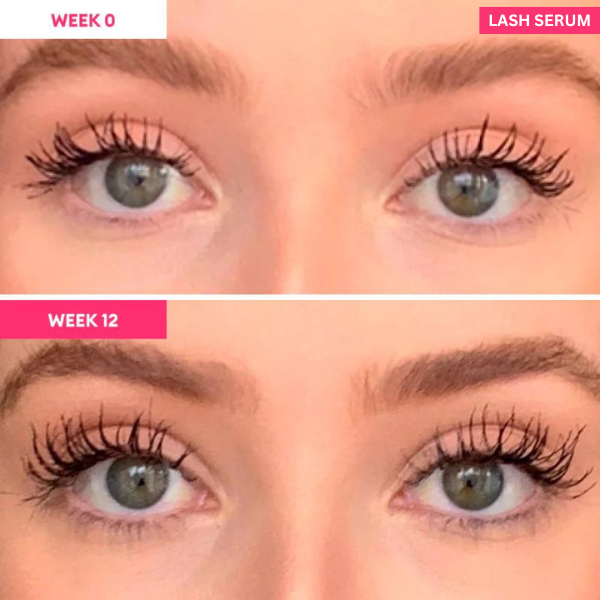 Eyelash Serum to Grow Lashes | Lash Serum That Works | Growth & Regrowth