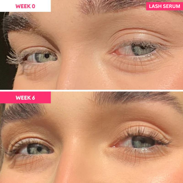 Eyelash Serum to Grow Lashes | Lash Serum That Works | Growth & Regrowth