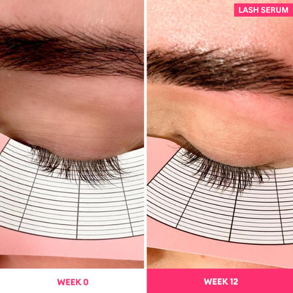 Eyelash Serum to Grow Lashes | Lash Serum That Works | Growth & Regrowth