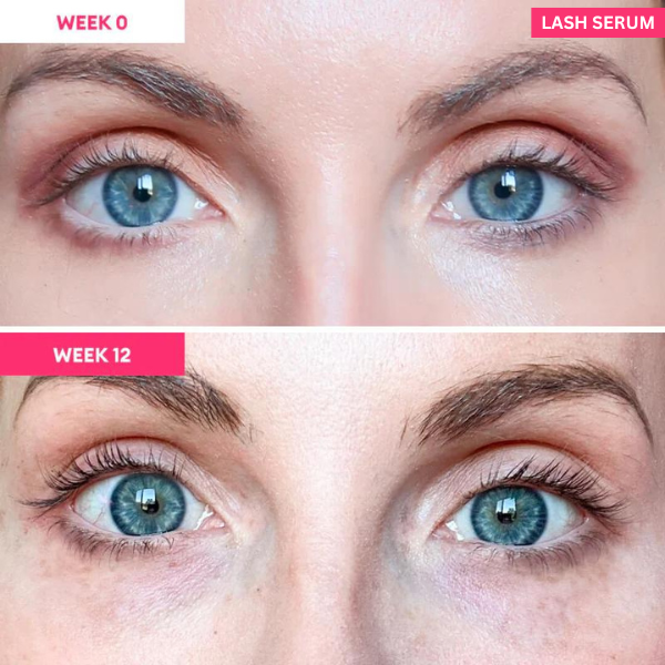 Eyelash Serum to Grow Lashes | Lash Serum That Works | Growth & Regrowth