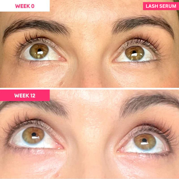 Wimpernserum für Wimpernwachstum | Wimpernserum, das wirkt | Wachstum und Nachwachsen 